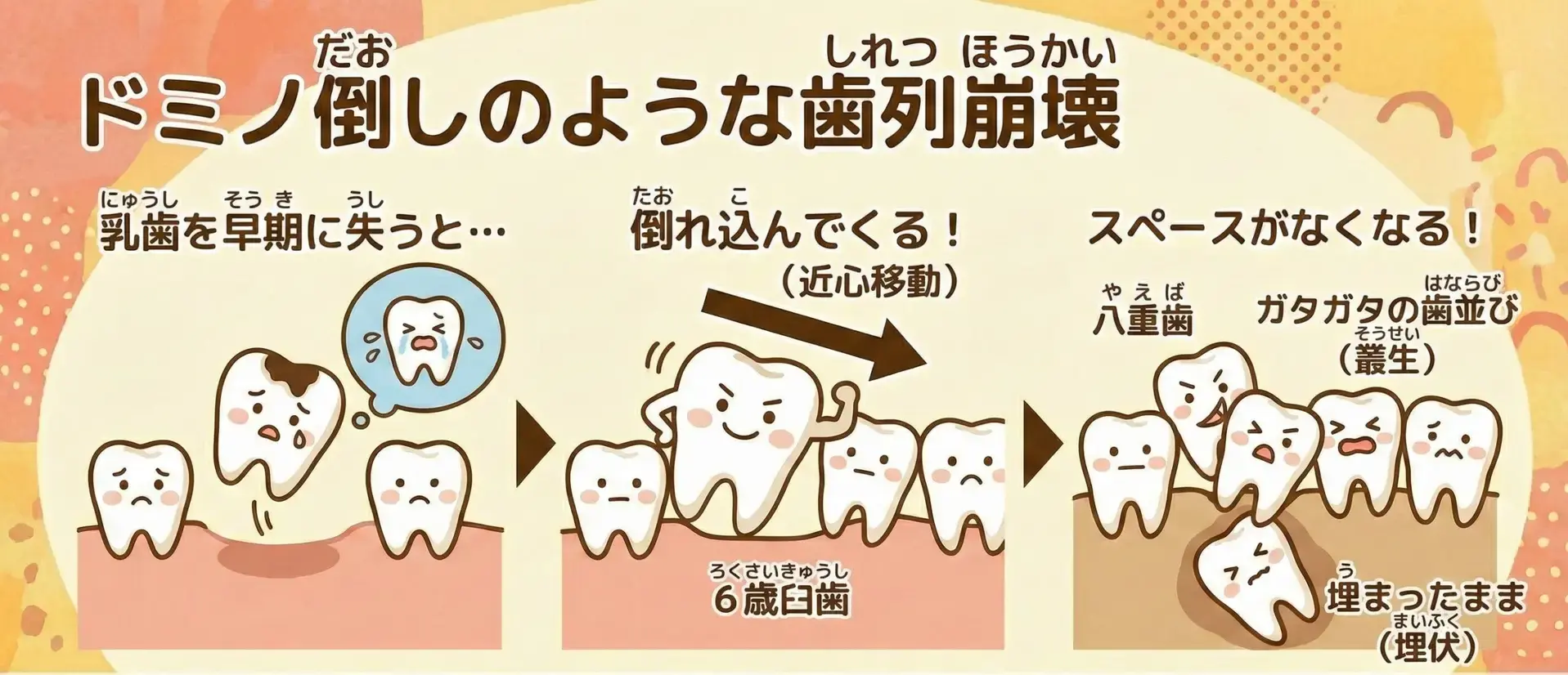 噛まないと顔が崩れるイメージ