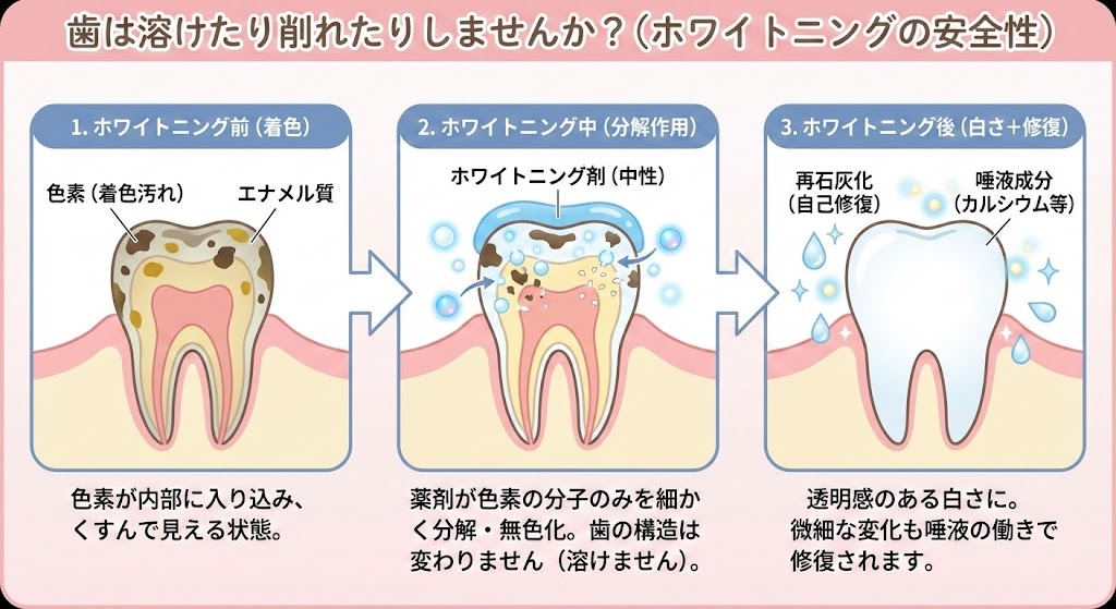 歯の健康状態を確認するイメージ