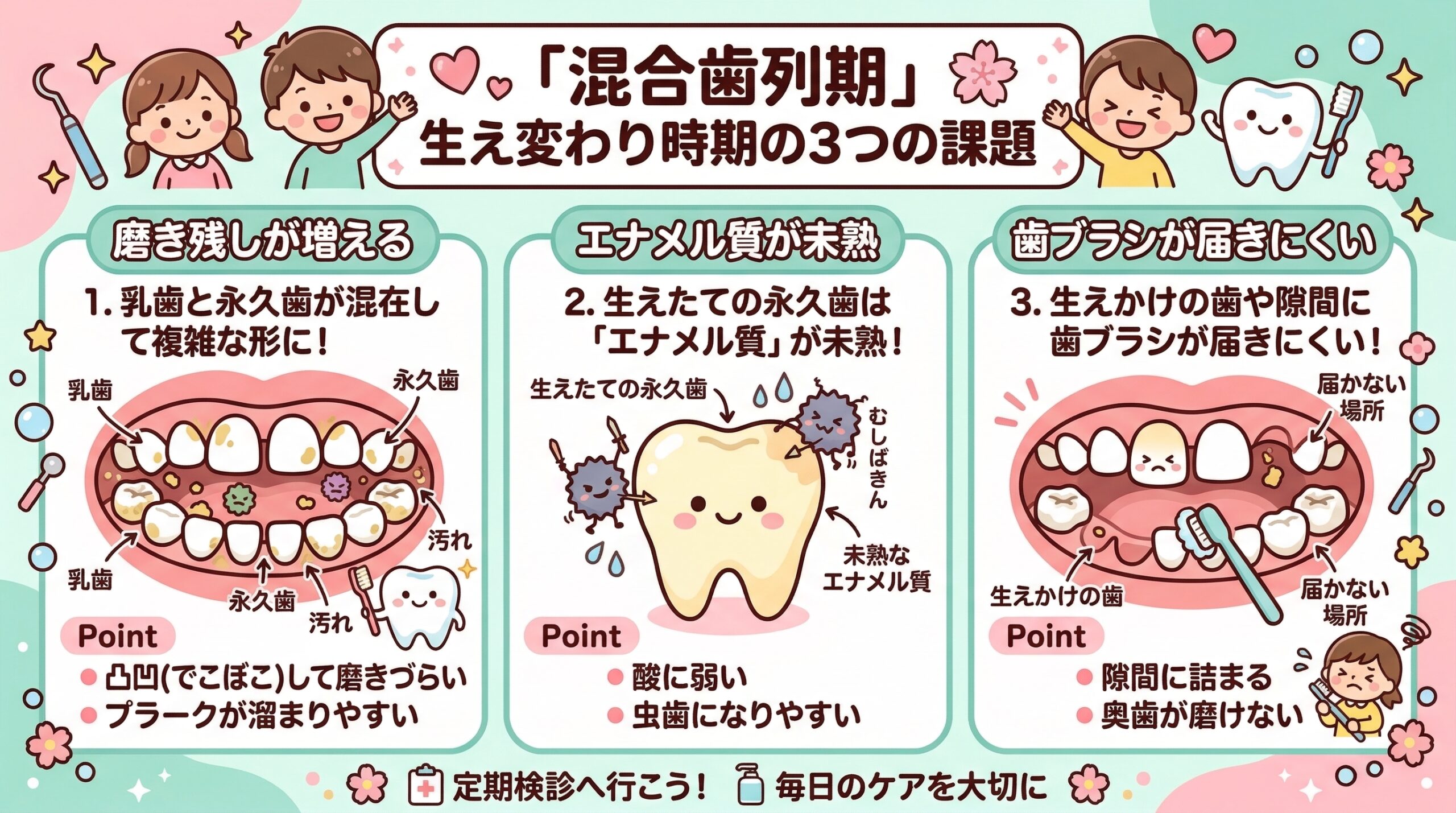 混合歯列期の図解 — 乳歯と永久歯が混在して磨き残しが増えやすい状態